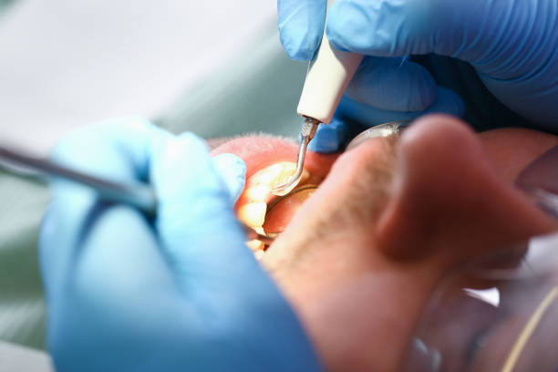 Best Urgent Dental Care for Toothache in Mccom, OH