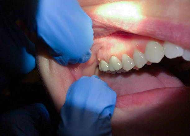 Best Emergency Dentist for Special Needs Patients in Mccom, OH